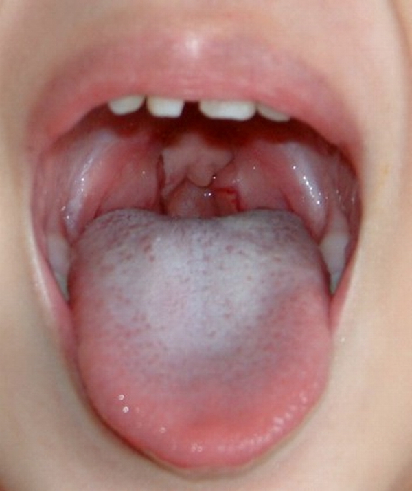 舌頭。口…第1張